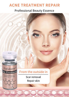 Meilleur produit de traitement de l' acné du visage éliminer l' acné peau lisse et rétrécir les pores sérum éclaircissant essence blanchissante