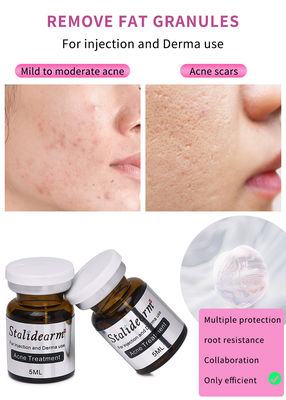 Produits de l'usine Résistant aux boutons Réparation de l'acné Traitement de l'acné Élimination des casques noirs Mesothérapie Serum injection OEM/ODM