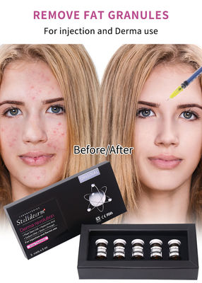 Produits de l'usine Résistant aux boutons Réparation de l'acné Traitement de l'acné Élimination des casques noirs Mesothérapie Serum injection OEM/ODM