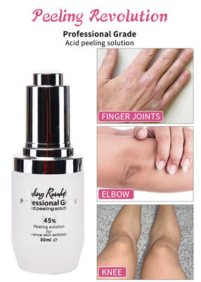 Solution de peeling acide de qualité professionnelle Liquid Set pour l' exfoliation du visage