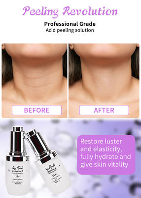 Sérum professionnel pour exfoliation du visage pour peeling de la peau