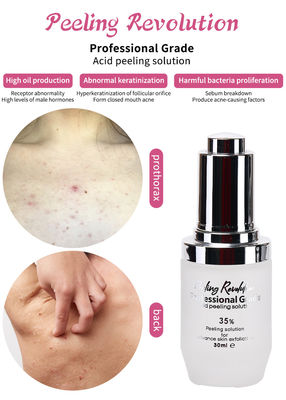 Sérum exfoliant Solution de peeling de la peau Détoxifiant de l' acné Soins de la peau Peeling de la peau 30 ml