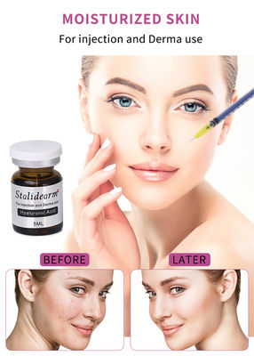 Stalidearm Acide hyaluronique sérum facial injectable pour améliorer la peau et la mésothérapie