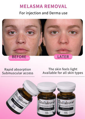 Injection d'exosomes pour le mélasma, solution de mésothérapie, produits de comblement dermique, sérum injectable