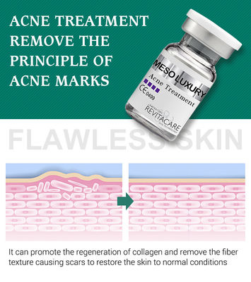 Sérum clair de bouton pur d'usine blanchissant le traitement Mesotherapy pour des cicatrices d'acné
