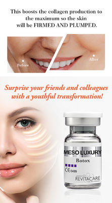 blanchiment du sérum MESO de Mesotherapy de sérum de Microneedling de sérum de BOTOX pour le visage