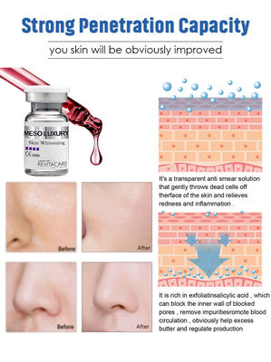 Le sérum meso DE LUXE Microneedling a immédiatement absorbé la peau blanchissant l'essence 10ML