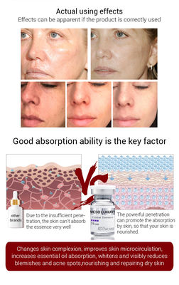Éclairage affermissant le sérum meso d'essence de caviar de Microneedling Mesotheraphy de sérum