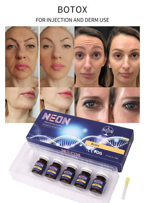 Injections transparentes de ride de sérum meso de thérapie de BOTOX anti