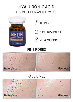Blanchissant la peau meso de sérum de thérapie éclairant des injections de l'acide hyaluronique 5ml anti-vieillissement