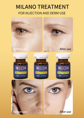 Sérum au néon de traitement de Melasma d'anthracnoses de tache de rousseur de sérum meso de thérapie de Milan