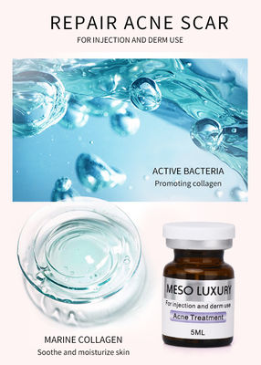 Les taches rouges de Mesotherapy de la jeunesse d'injection de luxe de sérum pèlent le traitement d'injection d'acné