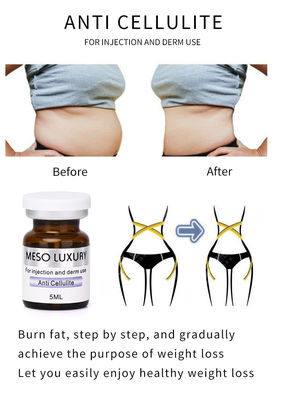 LUXURY Injecction Mesotherapy ( ANTI CELLULITE ) Slimming Meso SERUM Safely Losing Weight SERUM Removing Belly Body Fat