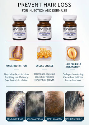Anti traitement de luxe d'injection de Mesotherapy de sérum de perte des cheveux pour la croissance de cheveux