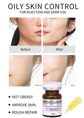 Exosomes de renforcement de la peau Traitement MESO sérum solution de mésothérapie pour la peau grasse