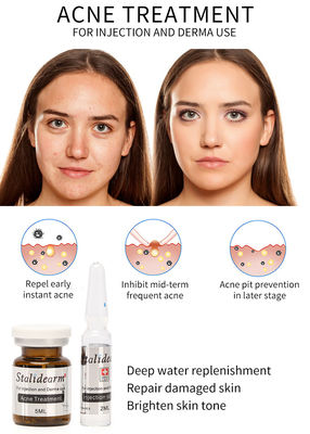 Exosome Skin Booster France Original Stalidearm Traitement de l' acné Injection sérum solution de mésothérapie