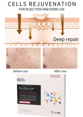Solution de mésothérapie d'injection de collagène pour le rajeunissement cellulaire de la peau par exosomes