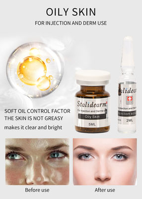 Traitement huileux de peau de Mesotherapy de contrôle d'huile d'injection de sérum de la jeunesse