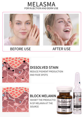 Coffre-fort de sérum d'utilisation d'injection de Melasma et bon ensemble de sérum de Mesotherapy 5ml/bottle d'effet