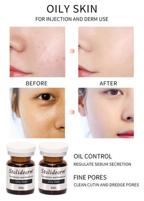 Le sérum d'injection pour essence sûre huileuse d'effet de la peau 5ml/Bottle la bonne a placé la marque originale de Stalidearm