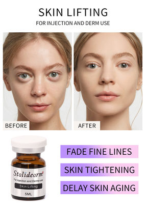 Effet naturel principal de levage des soins de la peau PRP d'injection de sérum d'injection de peau anti-vieillissement de Stalideram bon